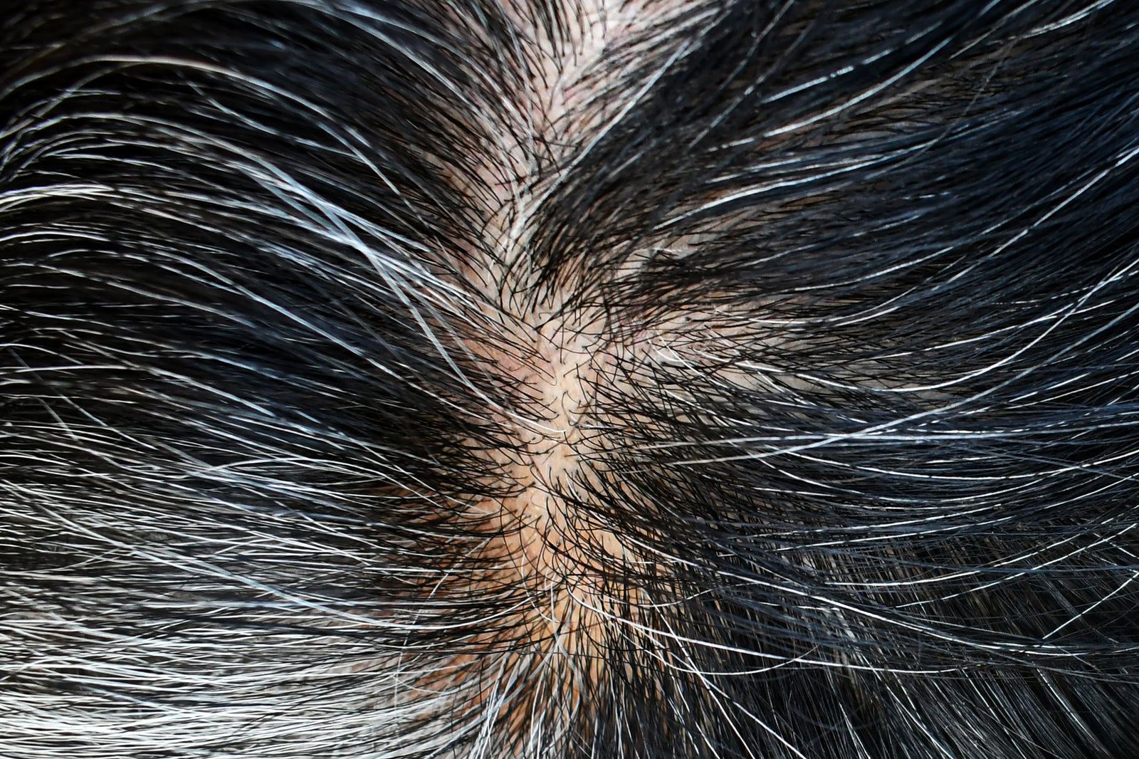 Does Collagen Help Hair Growth